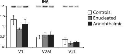 Western Blot: alpha-Internexin Antibody [NB300-139] - The expression of a-internexin (INA) was analyzed by Western blotting. White bars are controls, grey bars are enucleated and black bars are anophthalmic mice. Results from V1 (left), V2M (middle) and V2L (right) are shown. Image collected and cropped by CiteAb from the following publication (//dx.plos.org/10.1371/journal.pone.0159320) licensed under a CC-BY license.