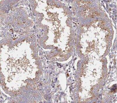 Immunohistochemistry-Paraffin: alpha-L-Iduronidase/IDUA Antibody [NBP2-48863] - Staining of human endometrium shows moderate cytoplasmic postivity in grandular cells.