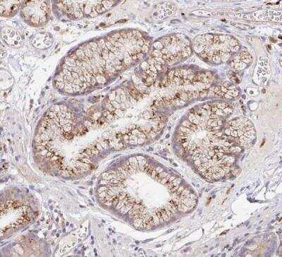 Immunohistochemistry-Paraffin: alpha-L-Iduronidase/IDUA Antibody [NBP2-48863] - Staining of human duodenum shows moderate cytoplasmic postivity in glandular cells.