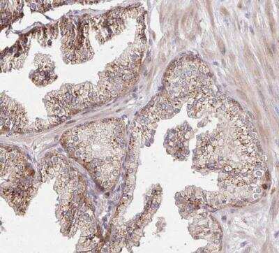 Immunohistochemistry-Paraffin: alpha-L-Iduronidase/IDUA Antibody [NBP2-48863] - Staining of human prostate shows moderate cytoplasmic postivity in glandular cells.