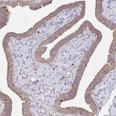 Immunohistochemistry-Paraffin: alpha-L-Iduronidase/IDUA Antibody [NBP2-48863] - Staining of human Fallopian tube shows moderate cytoplasmic positivity in glandular cells.