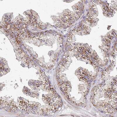 Immunohistochemistry-Paraffin: alpha-L-Iduronidase/IDUA Antibody [NBP2-49126] - Staining of human prostate shows strong positivity in cytoplasm granular in glandular cells.