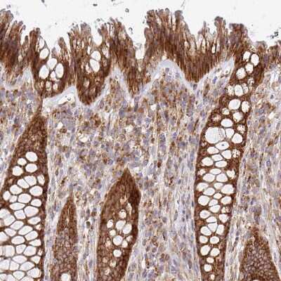 Immunohistochemistry-Paraffin: alpha-L-Iduronidase/IDUA Antibody [NBP2-49126] - Staining of human rectum shows strong positivity in cytoplasm granular in glandular cells.