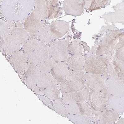 Immunohistochemistry-Paraffin: alpha-L-Iduronidase/IDUA Antibody [NBP2-49126] - Staining of human skeletal muscle shows low positivity as expected.