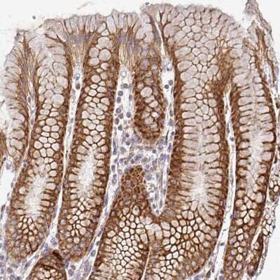 Immunohistochemistry-Paraffin: alpha-L-Iduronidase/IDUA Antibody [NBP2-49126] - Staining of human stomach shows strong positivity in cytoplasm granular in glandular cells.