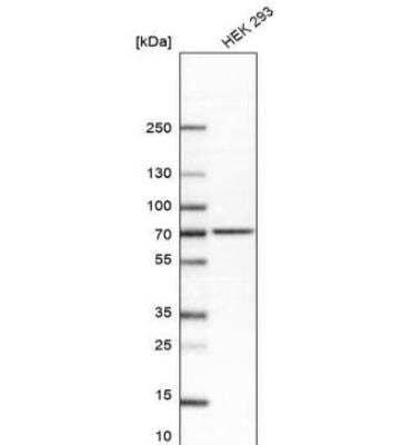 Western Blot: alpha-L-Iduronidase/IDUA Antibody [NBP2-48863] - Analysis in human cell line HEK 293.