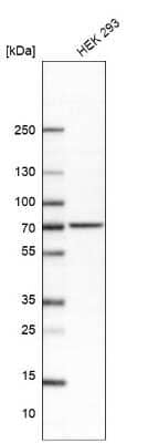 Western Blot: alpha-L-Iduronidase/IDUA Antibody [NBP2-48863] - TEST