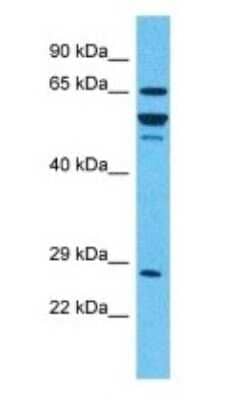 Western Blot: alpha-L-Iduronidase/IDUA Antibody [NBP3-10781] - Western blot analysis of alpha-L-Iduronidase/IDUA in 293T Whole Cell lysates. Antibody dilution at 1.0ug/ml