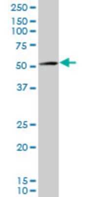 Western Blot: alpha-Methylacyl-CoA Racemase/AMACR Antibody (1D8) [H00023600-M02] - AMACR monoclonal antibody (M02), clone 1D8. Analysis of AMACR expression in HepG2.
