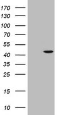 Western Blot: alpha-Methylacyl-CoA Racemase/AMACR Antibody (OTI5F10) [NBP2-45491] - Analysis of HEK293T cells were transfected with the pCMV6-ENTRY control (Left lane) or pCMV6-ENTRY AMACR.