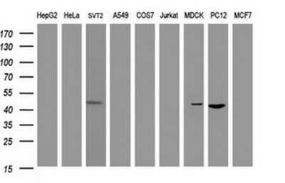 Western Blot: alpha-Methylacyl-CoA Racemase/AMACR Antibody (OTI5F10) [NBP2-45491] - Analysis of extracts (35ug) from 9 different cell lines (HepG2: human; HeLa: human; SVT2: mouse; A549: human; COS7: monkey; Jurkat: human; MDCK: canine; PC12: rat; MCF7: human).