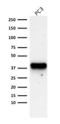 Western Blot: alpha-Methylacyl-CoA Racemase/AMACR Antibody (AMACR/1723) - Azide and BSA Free [NBP2-54501] - Western Blot Analysis of PC3 cell lysate using alpha-Methylacyl-CoA Racemase/AMACR Antibody (AMACR/1723).