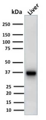 Western Blot: alpha-Methylacyl-CoA Racemase/AMACR Antibody (AMACR/1723) - Azide and BSA Free [NBP2-54501] - Western Blot Analysis of Liver tissue lysate using alpha-Methylacyl-CoA Racemase/AMACR Antibody (AMACR/1723).