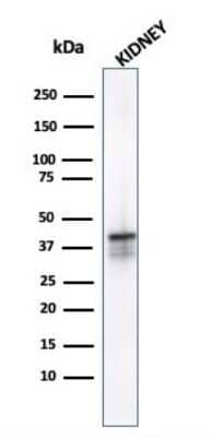 Western Blot: alpha-Methylacyl-CoA Racemase/AMACR Antibody (AMACR/1723) - Azide and BSA Free [NBP2-54501] - Western Blot analysis of Kidney tissue lysate using alpha-Methylacyl-CoA Racemase/AMACR antibody (AMACR/1723).