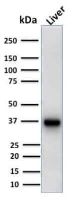 Western Blot: alpha-Methylacyl-CoA Racemase/AMACR Antibody (AMACR/1723) [NBP2-53390] - Western Blot Analysis of Liver tissue lysate using alpha-Methylacyl-CoA Racemase/AMACR Antibody (AMACR/1723).