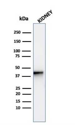 Western Blot: alpha-Methylacyl-CoA Racemase/AMACR Antibody (AMACR/4572R) - Azide and BSA Free [NBP3-08468] - Western Blot Analysis of human kidney tissue lysate using alpha-Methylacyl-CoA Racemase/AMACR Recombinant Rabbit Monoclonal Antibody (alpha-Methylacyl-CoA Racemase/AMACR/4572R).