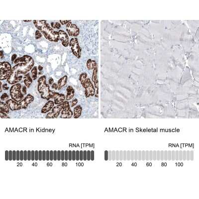 <b>Orthogonal Strategies Validation. </b>Immunohistochemistry-Paraffin: alpha-Methylacyl-CoA Racemase/AMACR Antibody (CL9360) [NBP2-88930] - Analysis in human kidney and skeletal muscle tissues using NBP2-88930 antibody. Corresponding AMACR RNA-seq data are presented for the same tissues.