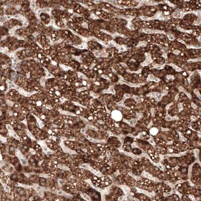 Immunohistochemistry-Paraffin: alpha-Methylacyl-CoA Racemase/AMACR Antibody (CL9362) [NBP2-88931] - Staining of human liver shows strong granular cytoplasmic positivity in hepatocytes.