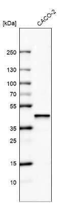 Western Blot: alpha-Methylacyl-CoA Racemase/AMACR Antibody (CL9362) [NBP2-88931] - Analysis in human cell line CACO-2.