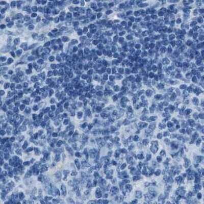 Immunohistochemistry-Paraffin: alpha-Methylacyl-CoA Racemase/AMACR Antibody [NBP1-87168] - Staining of human lymph node.