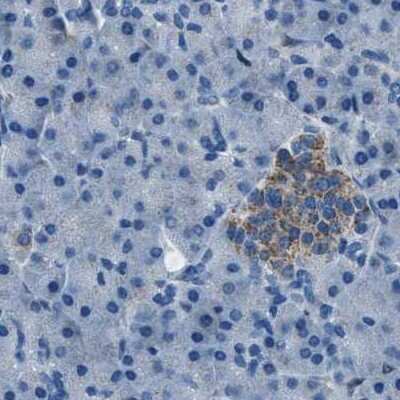 Immunohistochemistry-Paraffin: alpha-Methylacyl-CoA Racemase/AMACR Antibody [NBP1-87168] - Staining of human pancreas using Anti-AMACR antibody NBP1-87168.