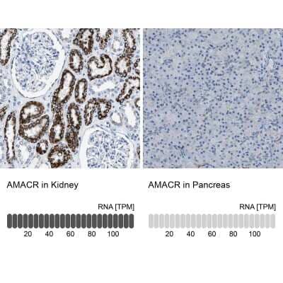 <b>Orthogonal Strategies Validation. </b>Immunohistochemistry-Paraffin: alpha-Methylacyl-CoA Racemase/AMACR Antibody [NBP1-87169] - Staining in human kidney and pancreas tissues using anti-AMACR antibody. Corresponding AMACR RNA-seq data are presented for the same tissues.