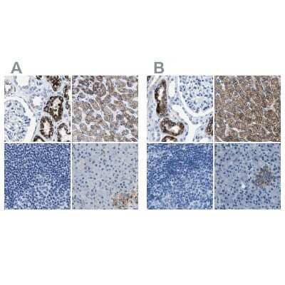 <b>Independent Antibodies Validation. </b>Immunohistochemistry-Paraffin: alpha-Methylacyl-CoA Racemase/AMACR Antibody [NBP1-87169] - Staining of human kidney, liver, lymph node and pancreas using Anti-AMACR antibody NBP1-87169 (A) shows similar protein distribution across tissues to independent antibody NBP1-87168 (B).