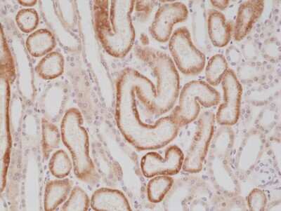 Immunohistochemistry: alpha-Methylacyl-CoA Racemase/AMACR Antibody (RM349) [NBP2-77417] - Immunohistochemical staining of formalin fixed and paraffin embedded human kidney tissue section using NBP2-77417.