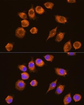 Immunocytochemistry/Immunofluorescence: alpha-N-acetylgalactosaminidase/NAGA Antibody [NBP2-92593] - Analysis of L929 cells using alpha-N-acetylgalactosaminidase/NAGA . Blue: DAPI for nuclear staining.