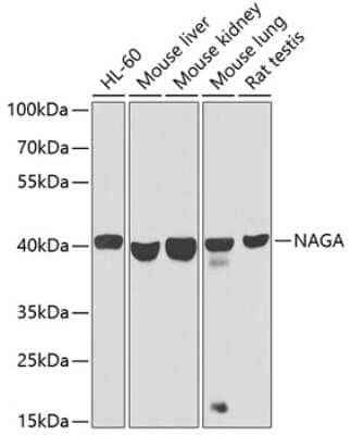 Western Blot: alpha-N-acetylgalactosaminidase/NAGA Antibody [NBP2-92593] - Analysis of extracts of various cell lines, using alpha-N-acetylgalactosaminidase/NAGA at 1:1000 dilution.Secondary antibody: HRP Goat Anti-Rabbit IgG (H+L) at 1:10000 dilution.Lysates/proteins: 25ug per lane.Blocking buffer: 3% nonfat dry milk in TBST.Detection: ECL Basic Kit .Exposure time: 30s.