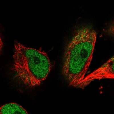 Immunocytochemistry/Immunofluorescence: alpha-N-terminal Methyltransferase 1A/METTL11A Antibody [NBP1-89255] - Staining of human cell line U-251 MG shows localization to nucleoplasm & cytosol. Antibody staining is shown in green.