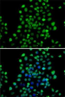 Immunocytochemistry/Immunofluorescence: alpha-N-terminal Methyltransferase 1A/METTL11A Antibody [NBP2-92670] - Analysis of A-549 cells using alpha-N-terminal Methyltransferase 1A/METTL11A . Blue: DAPI for nuclear staining.