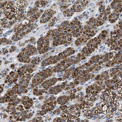 Immunohistochemistry-Paraffin: alpha-N-terminal Methyltransferase 1A/METTL11A Antibody [NBP1-89255] - Staining of human adrenal gland shows cytoplasmic positivity in cortical cells.