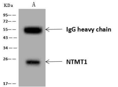 Immunoprecipitation: alpha-N-terminal Methyltransferase 1A/METTL11A Antibody [NBP3-12704] - Lane A:0.5 mg MCF-7 Whole Cell Lysate4 uL anti-NTMT1 rabbit polyclonal antibody and 60 ug of Immunomagnetic beads Protein A/G.Primary antibody:Anti-NTMT1 rabbit polyclonal antibody,at 1:100 dilution Secondary antibody:Goat Anti-Rabbit IgG (H+L)/HRP at 1/10000 dilutionDeveloped using the ECL technique.Performed under reducing conditions.Predicted band size: 25 kDaObserved band size :25 kDa
