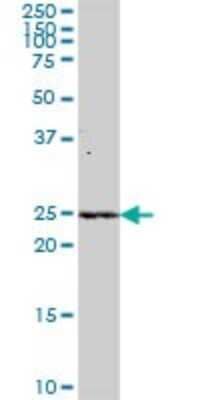 Western Blot: alpha-N-terminal Methyltransferase 1A/METTL11A Antibody [H00028989-B01P] - Analysis of C9orf32 expression in human liver.