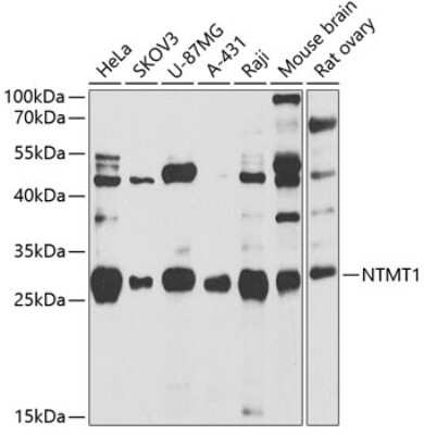 Western Blot: alpha-N-terminal Methyltransferase 1A/METTL11A Antibody [NBP2-92670] - Analysis of extracts of various cell lines, using alpha-N-terminal Methyltransferase 1A/METTL11A at 1:1000 dilution.Secondary antibody: HRP Goat Anti-Rabbit IgG (H+L) at 1:10000 dilution.Lysates/proteins: 25ug per lane.Blocking buffer: 3% nonfat dry milk in TBST.Detection: ECL Basic Kit .Exposure time: 60s.