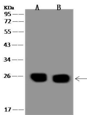 Western Blot: alpha-N-terminal Methyltransferase 1A/METTL11A Antibody [NBP3-12704] - Lane A: Hela Whole Cell LysateLane B: MCF-7 Whole Cell LysateLysates/proteins at 30 ug per lane.SecondaryGoat Anti-Rabbit IgG (H+L)/HRP at 1/10000 dilution.Developed using the ECL technique.Performed under reducing conditions.Predicted band size:25 kDaObserved band size:25 kDa