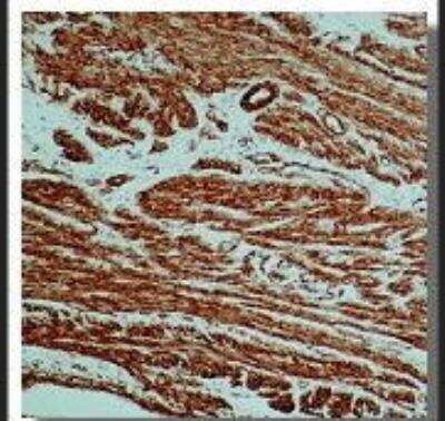 Immunohistochemistry-Paraffin: alpha-Smooth Muscle Actin Antibody (0.N.5) [NB120-18147] - Formalin-fixed, paraffin-embedded human leiomyoma for alpha-Smooth Muscle Actin using peroxidase-conjugate and DAB chromogen. Note cytoplasmic staning of smoth muscle cells.