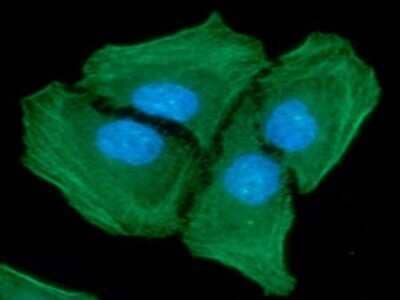 Immunocytochemistry/Immunofluorescence: alpha-Smooth Muscle Actin Antibody (132D3) [NBP2-59429] - Analysis of alpha-Smooth Muscle Actin in HeLa cells line, stained with DAPI (Blue) for nucleus staining and monoclonal alpha-Smooth Muscle Actin Antibody (132D3) (1:100) with goat anti-mouse IgG-Alexa fluor 488 conjugate (Green).