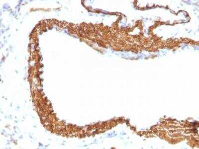 Immunohistochemistry-Paraffin: alpha-Smooth Muscle Actin Antibody (1A4 + ACTA2/791) [NBP2-47699] - Azide and BSA Free [NBP2-47699] - Paraffin-embedded Rat Lung stained with alpha-Smooth Muscle Actin Monoclonal Antibody (1A4 + ACTA2/791).