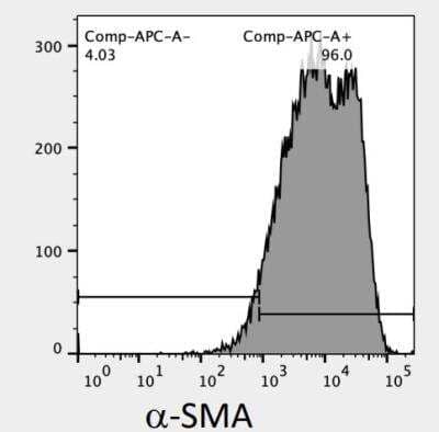 alpha-Smooth Muscle Actin expression in colorectal tumor cells. Image from verified customer review.