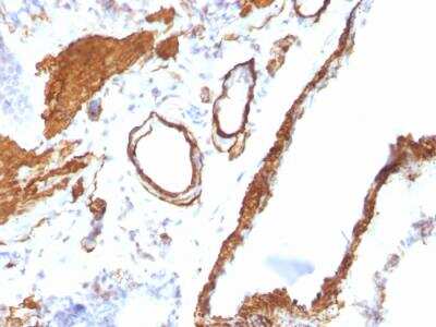 Immunohistochemistry-Paraffin: alpha-Smooth Muscle Actin Antibody (ACTA2/791) - IHC-Prediluted [NBP2-48132] - IHC-Prediluted [NBP2-48132] - Paraffin-embedded Rat Lung stained with alpha-Smooth Muscle Actin Antibody (ACTA2/791).