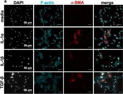 Immunohistochemistry: alpha-Smooth Muscle Actin Antibody (SPM332) [Allophycocyanin] [NBP2-34760APC] - IL-1 induces contractility and alpha smooth muscle actin expression in murine embryonic fibroblasts and primary hepatic stellate cells. MEFs were incubated with media, 10 ng/mL IL-1 alpha, 150 pg/mL IL-1 beta or 10 ng/mL TGFbeta-1 for 48 h. After fixation, MEFs were stained for F-actin, and alpha-smooth muscle actin (NBP2-34760APC). Image collected and cropped by CiteAb from the following publication (//pubmed.ncbi.nlm.nih.gov/32973293/) licensed under a CC-BY license.