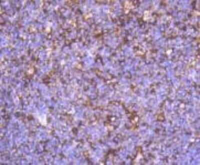 Immunohistochemistry-Paraffin: alpha-Smooth Muscle Actin Antibody (SY25-03) [NBP2-67436] - Analysis of paraffin-embedded human tonsil tissue using alpha-Smooth Muscle Actin Antibody (SY25-03). Counter-stained with hematoxylin.