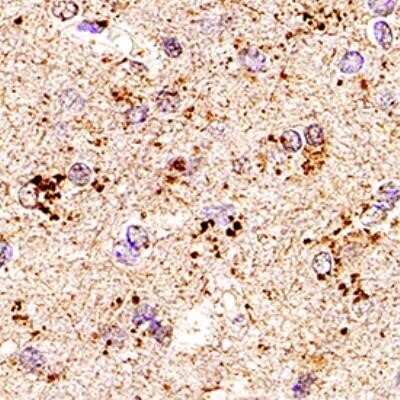 Immunohistochemistry: alpha-Synuclein Antibody (24.8) - Azide and BSA Free [NBP2-80572] - Analysis of FFPE human brain using alpha-Synuclein antibody (clone 24.8) at 1:200 on a Bond Rx autostainer (Leica Biosystems). The assay involved 20 minutes of heat induced antigen retrieval (HIER) using 10mM sodium citrate buffer (pH 6.0) and endogenous