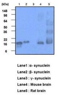 Western Blot: Synuclein alpha/beta Antibody (3B6) [NBP1-22957] - The recombinant human synuclein family (alpha-,beta- and gamma-) (each 20ng), Mouse brain and Rat brain (30ug) were resolved by SDS-PAGE, transferred to PVDF membrane and probed with anti-human alpha,beta-synuclein (1:1000). Proteins were visualized using a goat anti-mouse secondary antibody conjugated to HRP and an ECL detection system.