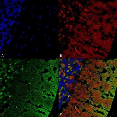 Immunohistochemistry: alpha-Synuclein Antibody (3C11) [NBP3-18258] - Immunohistochemistry analysis using Mouse Anti-alpha-Synuclein Monoclonal Antibody, Clone 3C11 (NBP3-18258). Tissue: cerebellum. Species: Rat. Fixation: Formalin fixed, paraffin embedded. Primary Antibody: Mouse Anti-alpha-Synuclein Monoclonal Antibody (NBP3-18258) at 1:25 for 1 hour at RT. Secondary Antibody: Goat Anti-Mouse IgG: Alexa Fluor 488. Counterstain: Actin-binding Phalloidin-Alexa Fluor 633; DAPI (blue) nuclear stain. Magnification: 63X. (A) DAPI (blue) nuclear stain. (B) Phalloidin Alex Fluor 633 F-Actin stain. (C) alpha-Synuclein Antibody (D) Composite.