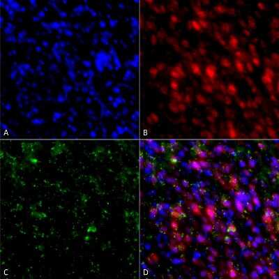 Immunocytochemistry/Immunofluorescence: alpha-Synuclein Antibody (4F1) [NBP3-18259] - Immunocytochemistry/Immunofluorescence analysis using Mouse Anti-alpha-Synuclein Monoclonal Antibody, Clone 4F1 (NBP3-18259). Tissue: Primary hippocampal neurons treated with active alpha-Synuclein Protein Aggregate (SPR-322) at 4 ug/ml to induce fibrils. Species: Rat. Fixation: 4% paraformaldehyde. Primary Antibody: Mouse Anti-alpha-Synuclein Monoclonal Antibody (NBP3-18259) at 1:200 for 24 hours at 4C. Secondary Antibody: Goat Anti-Mouse Alexa Fluor 488 at 1:700 for 1 hour at RT. Counterstain: Guinea Pig Anti-NeuN (red) neuronal marker (Donkey Anti-Guinea Pig Alexa Fluor 647 1:700); DAPI (blue) nuclear stain at 1:6000, 1:3000 for 60 min at RT, 5 min at RT. Magnification: 20X. (A) DAPI (blue) nuclear stain. (B) NeuN neuronal marker (red). (C) alpha-Synuclein Antibody. (D) Composite.