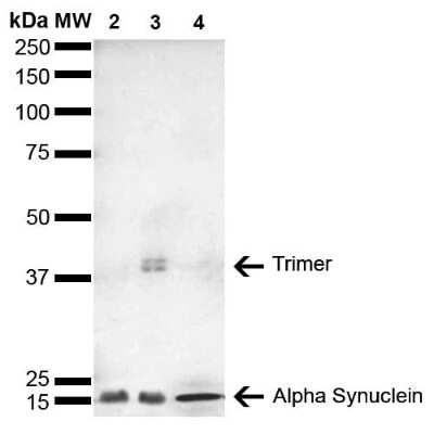 Western Blot: alpha-Synuclein Antibody (4F1) [NBP3-18259] - Western Blot analysis of Human, Mouse, Rat Brain showing detection of 14 kDa alpha-Synuclein protein using Mouse Anti-alpha-Synuclein Monoclonal Antibody, Clone 4F1 (NBP3-18259). Lane 1: Molecular Weight Ladder (MW). Lane 2: Mouse Brain cell lysate. Lane 3: Rat brain cell lysate. Lane 4: Human brain cell lysate. Load: 15 ug. Block: 5% Skim Milk in 1X TBST. Primary Antibody: Mouse Anti-alpha-Synuclein Monoclonal Antibody (NBP3-18259) at 1:1000 for 2 hours at RT. Secondary Antibody: Goat Anti-Mouse HRP:IgG at 1:3000 for 1 hour at RT. Color Development: ECL solution (Super Signal West Pico) for 5 min in RT. Predicted/Observed Size: 14 kDa. Other Band(s): ~40 kDa (trimer).