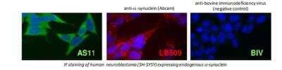 Immunocytochemistry/Immunofluorescence: alpha-Synuclein Antibody (AS11) [HRP] [DDX0910-HRPO-100] - IF staining of human neuroblastoma (SH-SY5Y) expressing endogenousa-synuclein